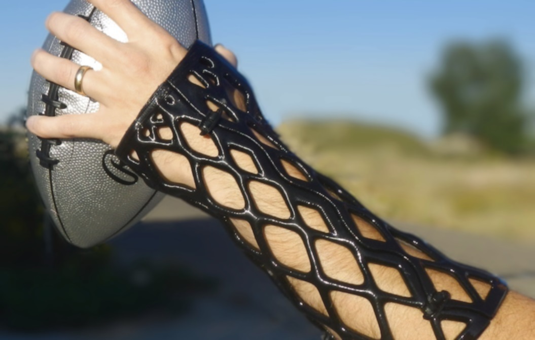 3D-printed-splint-spotlight-b